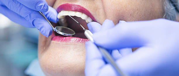 Best Emergency Treatment for Dental Infections or Abscesses in Delmar, MD
